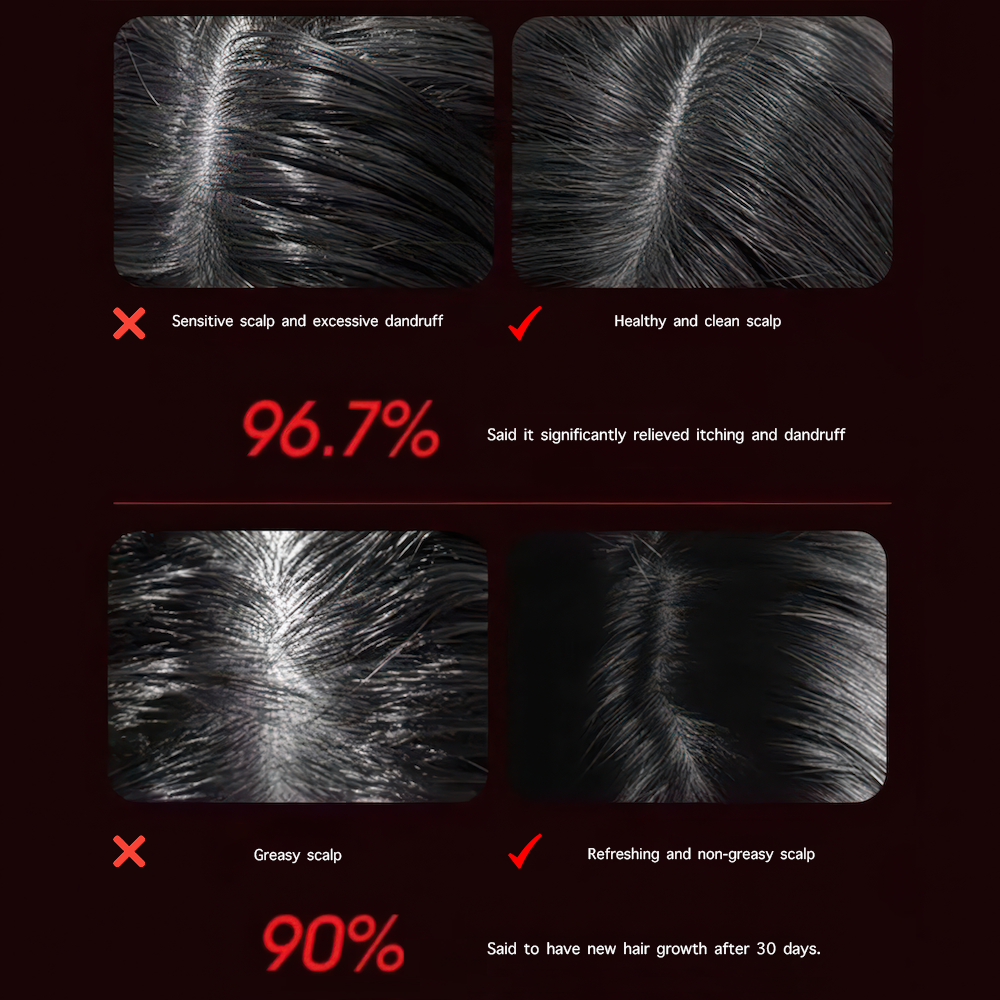 SootheScalp - 3-in-1 Scalp Massager